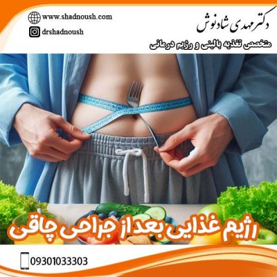 رژیم غذایی بعد از جراحی چاقی - دکتر مهدی شادنوش 